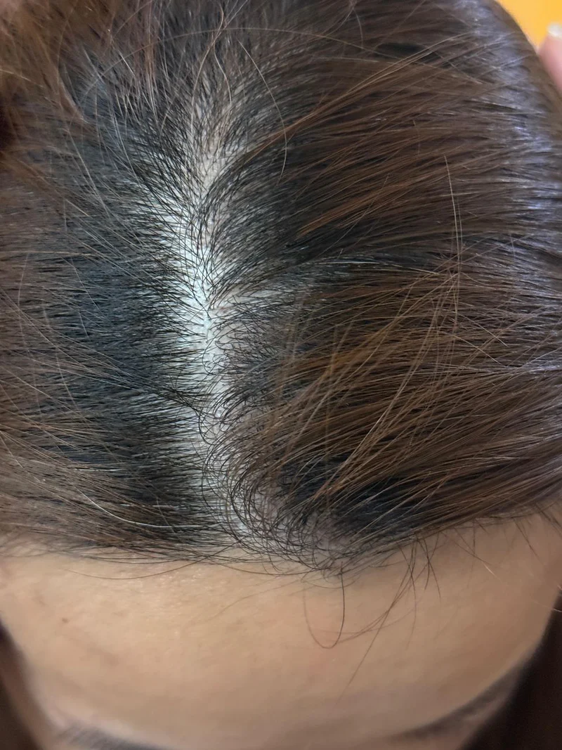 Day 1 Yachu Hair Oil Progress