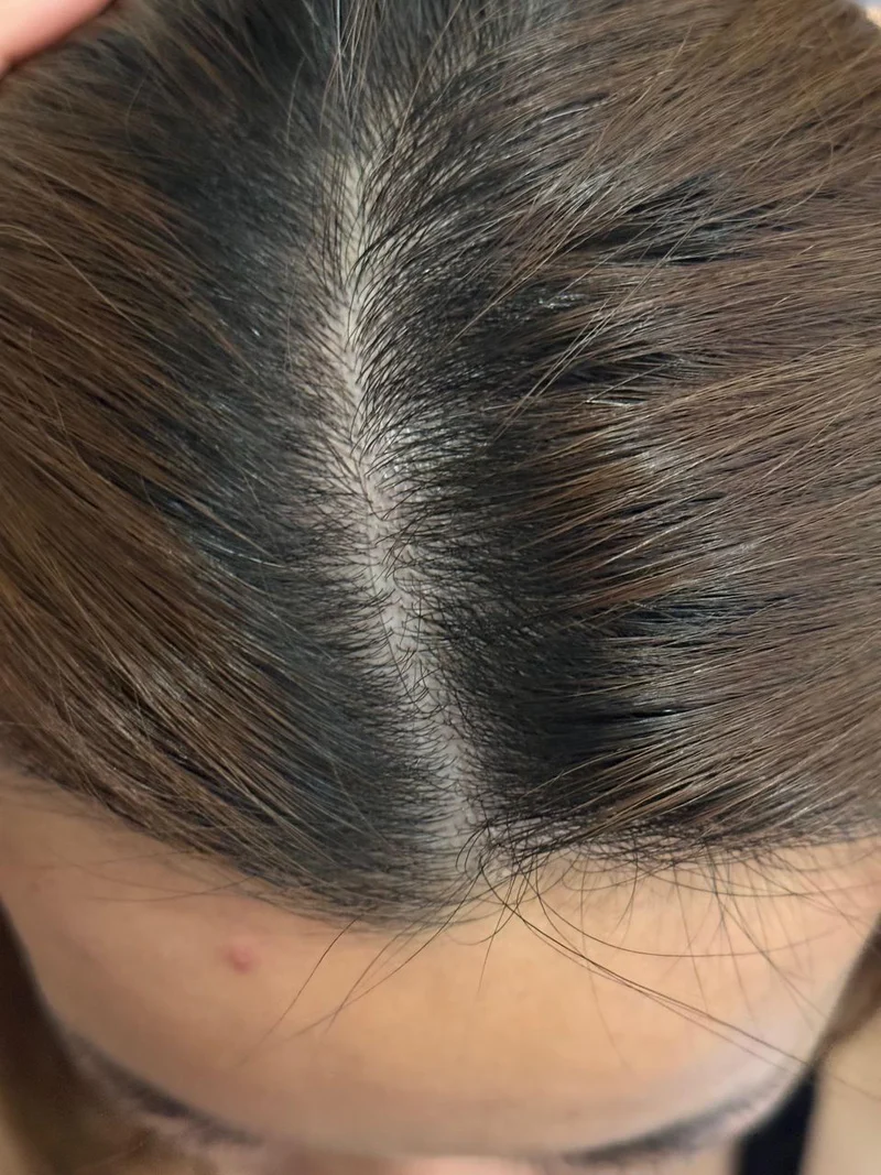 Day 30+ Yachu Hair Oil Progress