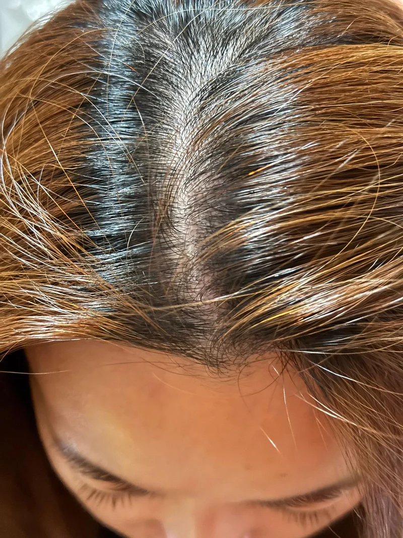 Day 60+ Yachu Hair Oil Progress